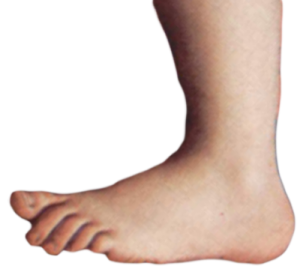 Monty Foot